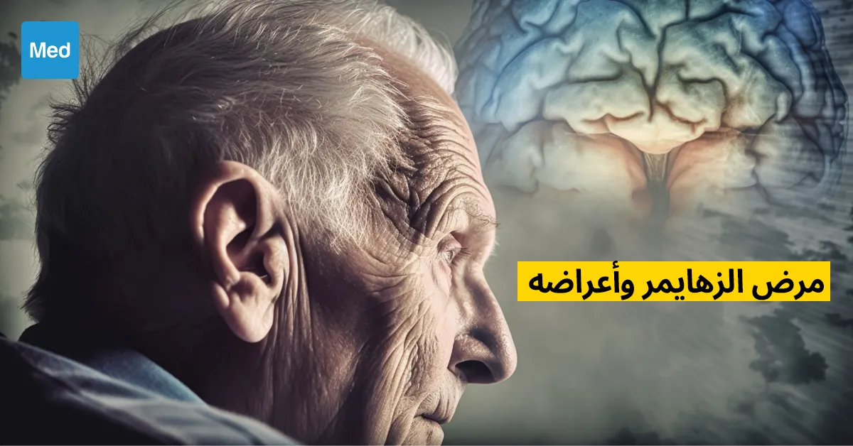 مرض الزهايمر وأعراضه